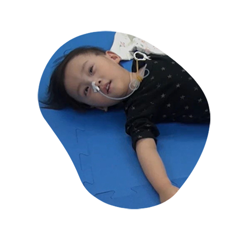AADCd Patient